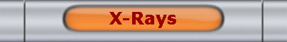 X-Rays